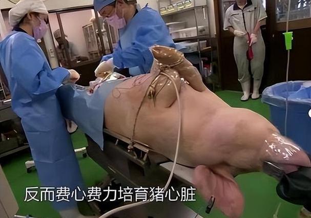 移植猪心脏后的基因污染（猪的心脏可以移植给人类吗有什么后遗症）