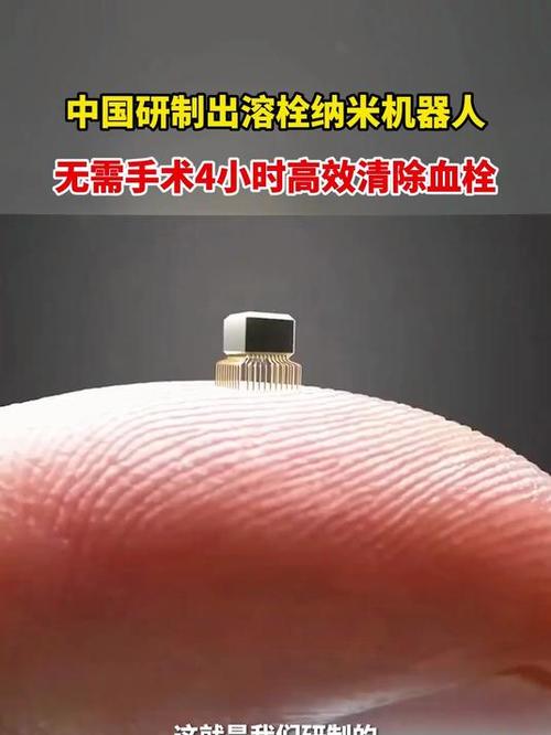 纳米机器人清除血栓实录(纳米机器人溶栓)