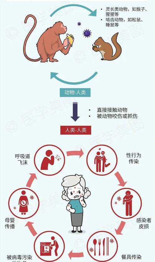 病毒传播类比文化入侵(病毒传播类比文化入侵的特点)
