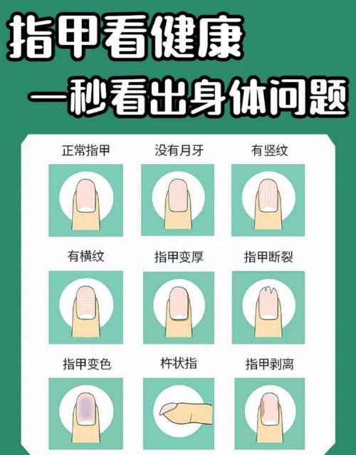 指甲生长速度与月相(指甲生长速度与年龄有关吗)